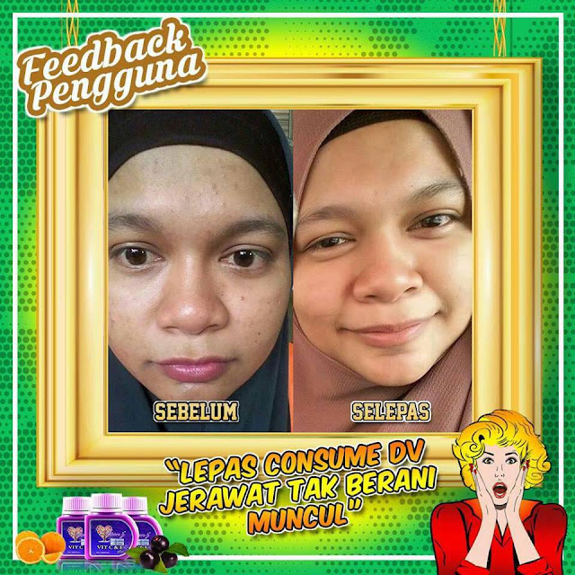 testimoni Dianz vitamin 2017