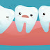 Nhổ răng khôn hàm trên giá bao nhiêu?