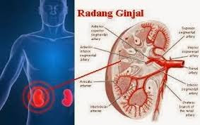 Cara Ampuh Menyembuhkan Radang Ginjal ( Nefritis ) Secara Alami