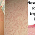 Get rid of ingrown hair