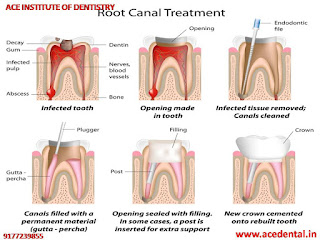 Endodontic Certificate Course