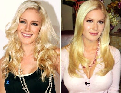 heidi montag before and after 2010. heidi montag before and after