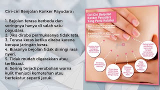 obat kanker payudara stadium iv, obat mengatasi kanker payudara, kanker payudara jurnal pdf, kanker payudara ibu hamil, kanker payudara keluar nanah, pengobatan kanker payudara secara herbal, kapsul herbal kanker payudara, pengobatan medis untuk kanker payudara, kunir putih obat kanker payudara, ciri2 gejala awal kanker payudara, kanker payudara stadium 4, mengatasi kanker payudara stadium 4, perbedaan kanker payudara jinak dan ganas, cara mengobati kanker payudara yg sudah pecah, obat kanker payudara stadium iv, obat kanker payudara yang manjur, obat kangker payudara paling ampuh, pengobatan kanker payudara setelah kemoterapi, penyembuhan kanker payudara tanpa operasi, pengobatan kemoterapi pada kanker payudara, obat herbal mujarab kanker payudara, mendeteksi kanker payudara pada pria, penyembuhan kanker payudara stadium 3, cara mengobati kanker payudara laki laki, cara mengobati kanker payudara pada laki laki, kanker payudara her2, jamu obat kanker payudara