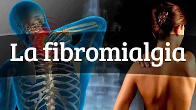 fibromialgia-preguntas frecuentes-768x432