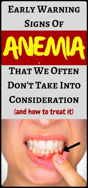 7 Signs of Anemia That You May Not Be Aware Of And How To Treat It