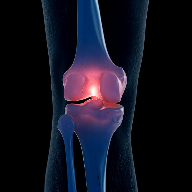 Osteoarthritis Treatment Market