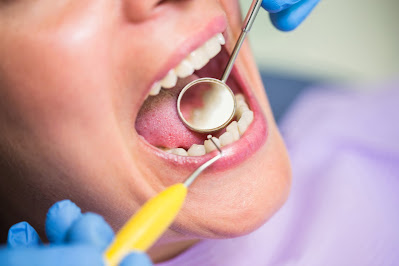 teeth scaling treatment in rajkot