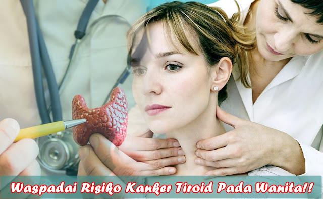 Kanker Tiroid Pada Wanita