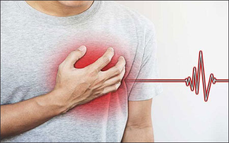 Paroxysmal Supraventricular Tachycardia