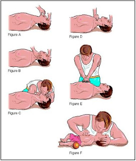 AmerSafeSchool.com Blog: CPR Steps