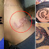 Warning - ‘Black Henna’ Tattoos May Cause Allergic Reactions And Leave You Literally Scarred For Life