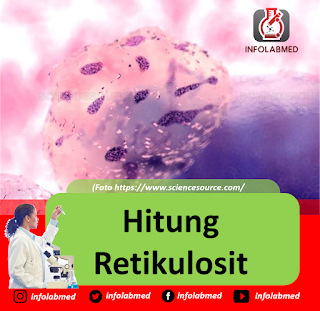 Hitung Retikulosit