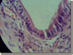 Simple columnar histology_thumb