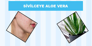 sivilce oluşumuna engel aloe vera