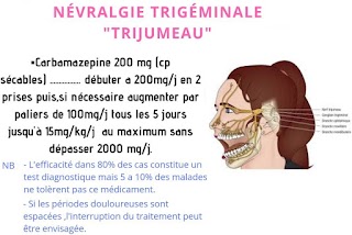 Névralgie du trijumeau