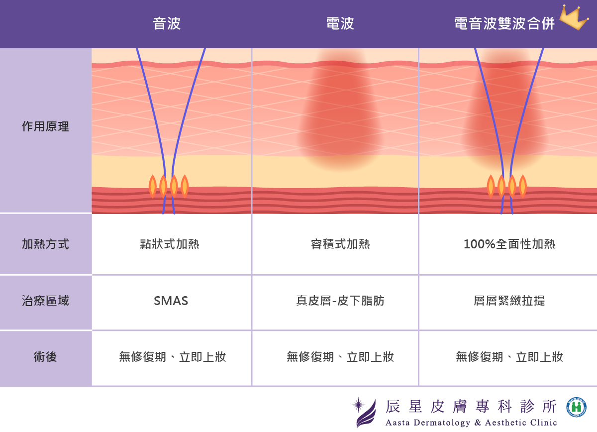 辰星皮膚專科診所電音波比較圖