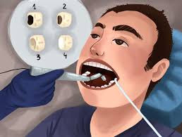 How to get rid teeth cavity