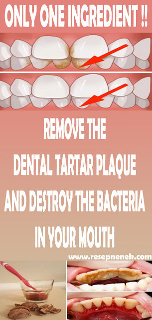 REMOVE THE DENTAL TARTAR PLAQUE AND DESTROY THE BACTERIA IN YOUR MOUTH WITH ONLY ONE INGREDIENT