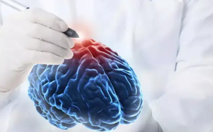 Understanding the Neurosurgical Approach to Brain Hemorrhages
