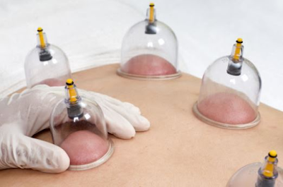 Hijama Training Institute in Rajasthan, Hijama training, Hijama Training Center in Rajasthan, Hijama Course in Rajasthan,hijama course online,,hijama therapy training center,hijama therapy classes