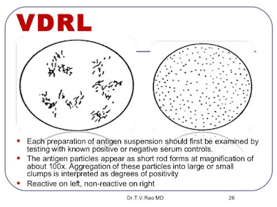 rpr test