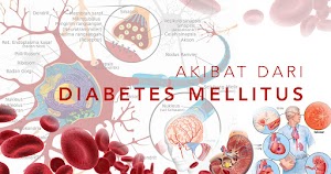 Jual Obat Herbal Diabetes Ampuh Di Banyumas | WA : 0822-3442-9202