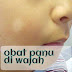 Obat Panu di Wajah (pityriasis alba)
