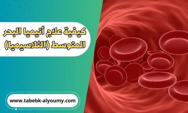 كيفية علاج أنيميا البحر المتوسط الثلاسيميا