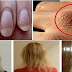 Urgent!, If you have fragile nails, dry skin and lose a lot of hair, you have to read this