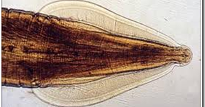 KOLEKSI TUGASAN: PARASITOLOGI : Toxocara Cati