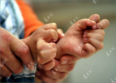 Boy with 31 Fingers and Toes Seen On www.coolpicturegallery.net