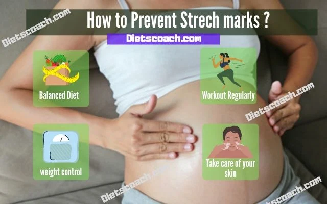 How to prevent Strech Marks?