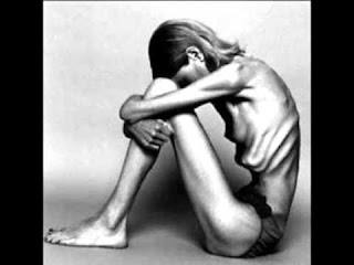 Anorexia - foto de jovem