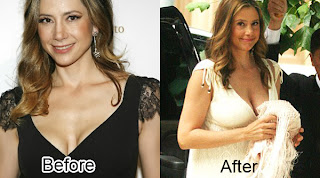 Chatter Busy: Mira Sorvino Plastic Surgery