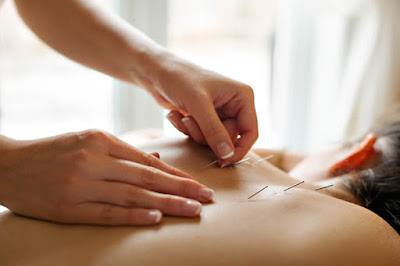 http://dralexcoulsonnd.com/category/chronic-pain-acupuncture/