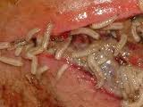 57 Maggots Removed from Woman's Ear