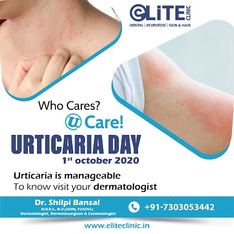 URTICARIA DAY