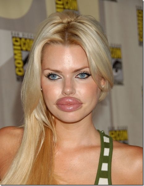 silicone-lips-fail-1