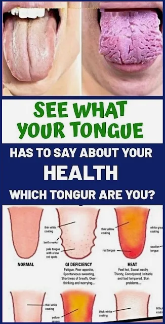 What Your Tongue Says About Your Health