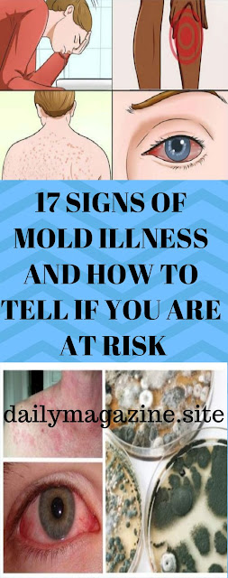 17 SIGNS OF MOLD ILLNESS AND HOW TO TELL IF YOU ARE AT RISK