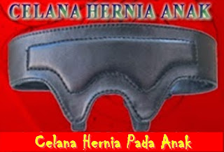 Keunggulan Celana Korset Hernia Pada Bayi