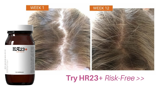 women's hair growth supplement