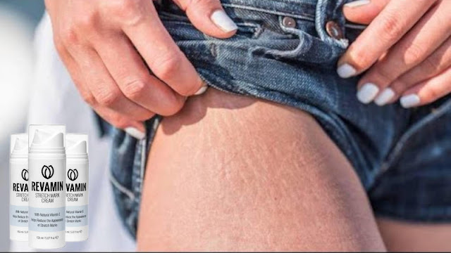 A super-effective way to deal with stretch Mark