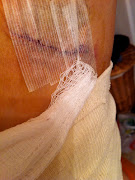 Reconstructing Breast Cancer: Tattoos