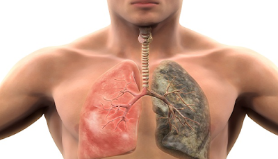 The Complete Lung Detoxification Guide Review