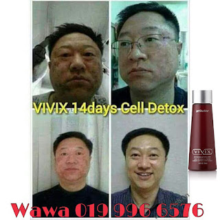 Testimoni, Testimoni Vivix, Vivix shaklee, Pengedar Shaklee Johor, Pengedar Vivix Johor, Pengedar Vivix Shaklee, vivix shaklee reviews shaklee vivix side effects vivix shaklee harga 2016 vivix shaklee price vivix shaklee testimonials vivix shaklee cancer vivix shaklee ingredients shaklee vivix malaysia shaklee vivix side effects vivix shaklee cara makan vivix untuk sakit buah pinggang ubat buah pinggang paling mujarab makanan untuk pesakit buah pinggang cara mencegah sakit buah pinggang buah pinggang rosak penawar sakit pinggang daun sup cuci buah pinggang tanda sakit buah pinggang tahap 4 ubat sakit pinggang yang mujarab does shaklee vivix work vivix shaklee cara makan shaklee vivix cancer shaklee vivix ingredients shaklee vivix benefits shaklee vivix review shaklee vivix price shaklee vivix testimonials Images for shaklee vivix cancer shaklee cancer testimonials shaklee cancer treatment nutriferon and cancer nutriferon negative side effects shaklee nutriferon side effects does shaklee vivix work shaklee vivix side effects shaklee vivix testimonials