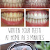 Whiten Your Teeth at Home in 3 Minutes