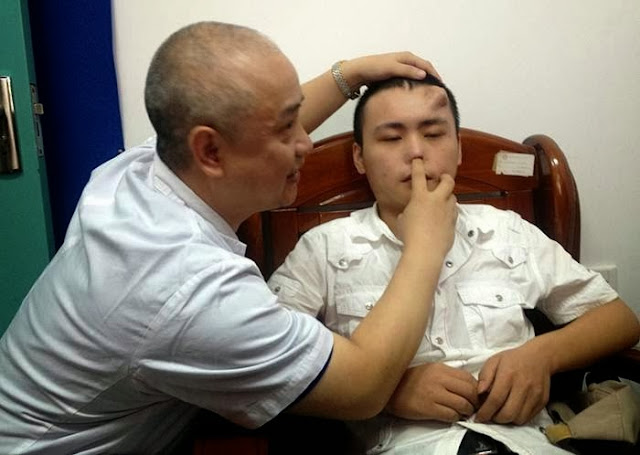 Chinese Doctors Grow Nose on Man's Forehead