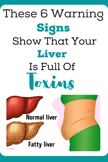  6 Signs That Your Liver Is Full Of Toxins And Making You Fat (And How To Stop It)