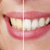 5 formas de blanquear los dientes naturalmente.